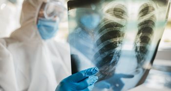 How to diagnose pneumonia
